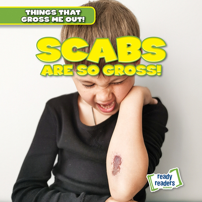 Scabs Are So Gross! 1482471442 Book Cover