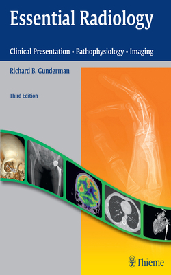 Essential Radiology: Clinical Presentation - Pa... 1604065737 Book Cover