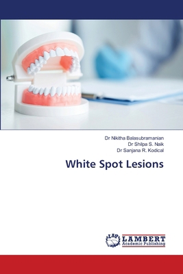White Spot Lesions 6208010624 Book Cover