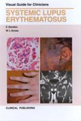 Systemic Lupus Erythemus: Visual Guide for Clin... 1846921007 Book Cover