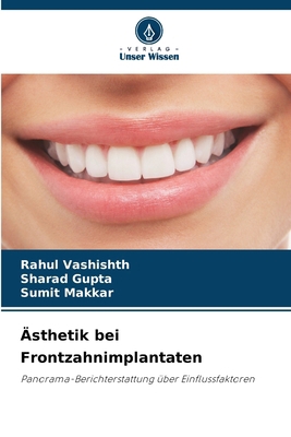 Ästhetik bei Frontzahnimplantaten [German] 6208917077 Book Cover