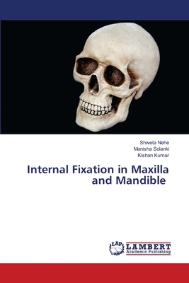 Internal Fixation in Maxilla and Mandible 6207473906 Book Cover