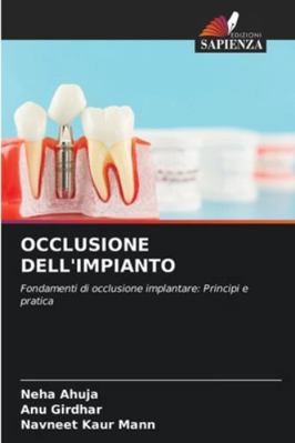 Occlusione Dell'impianto [Italian] 620871575X Book Cover