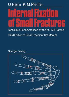 Internal Fixation of Small Fractures: Technique... 3540177280 Book Cover
