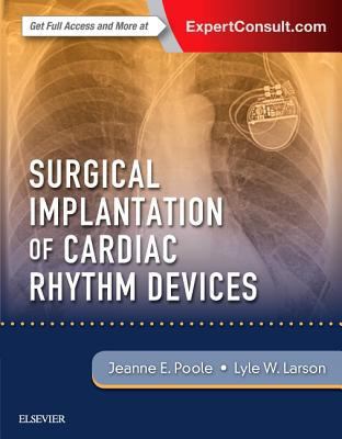 Surgical Implantation of Cardiac Rhythm Devices 0323401260 Book Cover