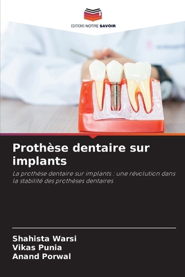 Prothèse dentaire sur implants [French] 6209235387 Book Cover