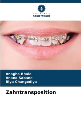 Zahntransposition [German] 6209687369 Book Cover