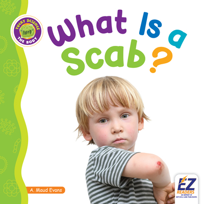 What Is a Scab? 1584159995 Book Cover