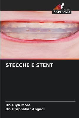 Stecche E Stent [Italian] 620777972X Book Cover