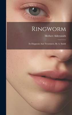 Ringworm: Its Diagnosis And Treatment, By A. Smith 1019717238 Book Cover