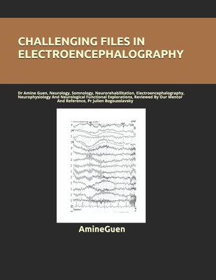 Challenging Files in Electroencephalography: Dr... B08DBNHDL2 Book Cover