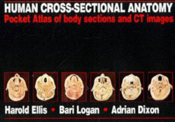 Human Cross-Sectional Anatomy: Pocket Atlas of ... 0750620285 Book Cover