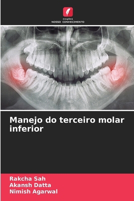 Manejo do terceiro molar inferior [Portuguese] 3639792602 Book Cover