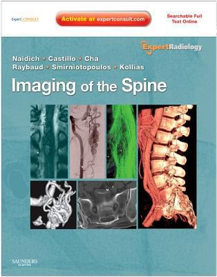 Imaging of the Spine [With Access Code] B0082M2KDS Book Cover
