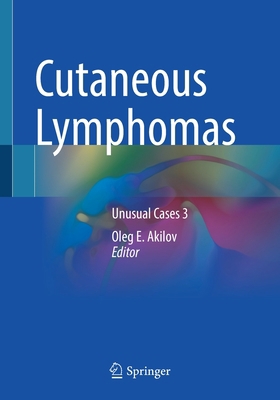 Cutaneous Lymphomas: Unusual Cases 3 303059131X Book Cover