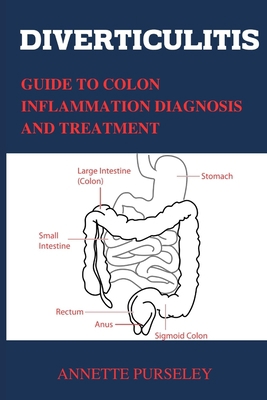 Diverticulitis: Guide To Colon Inflammation Dia... [Large Print] B0C6W97198 Book Cover