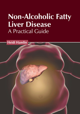 Non-Alcoholic Fatty Liver Disease: A Practical ... 1646475631 Book Cover