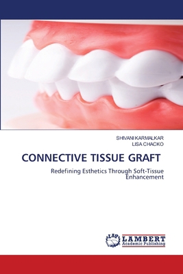 Connective Tissue Graft 6209453384 Book Cover