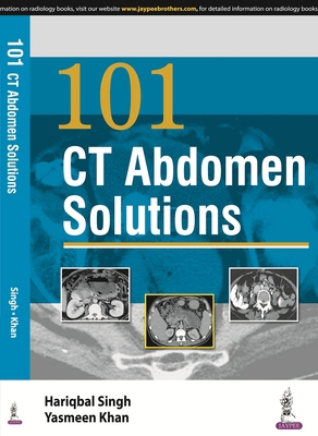 101 CT Abdomen Solutions 9352501810 Book Cover
