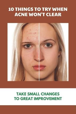10 Things To Try When Acne Won't Clear: Take Sm... B092P62VYR Book Cover