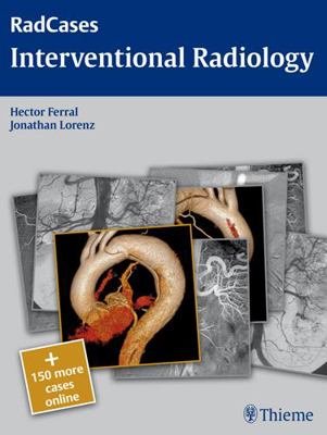 Radcases Interventional Radiology 1604061774 Book Cover