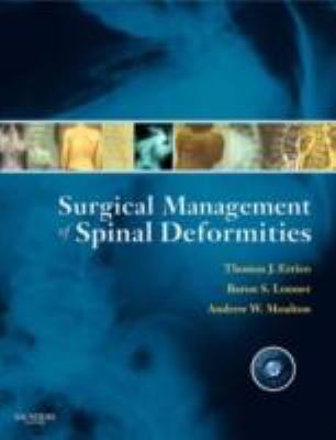 Surgical Management of Spinal Deformities [With... 1416033726 Book Cover