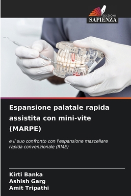 Espansione palatale rapida assistita con mini-v... [Italian] 620750237X Book Cover