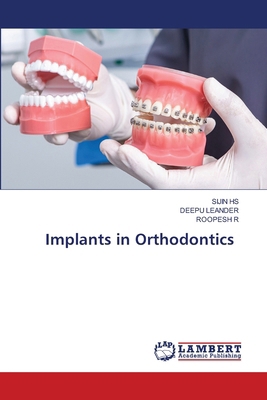 Implants in Orthodontics 6208428327 Book Cover