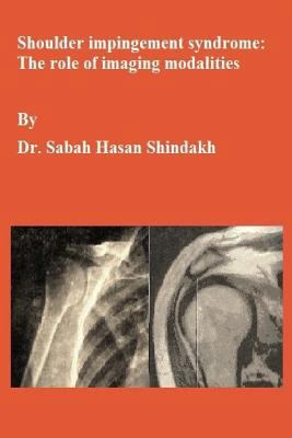 Shoulder impingement syndrome: The role of imag... 1729543642 Book Cover