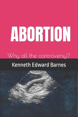 Abortion: Why all the controversy? 1521549311 Book Cover