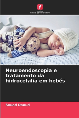 Neuroendoscopia e tratamento da hidrocefalia em... [Portuguese] 620570479X Book Cover