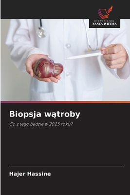 Biopsja wątroby [Polish] 6209430406 Book Cover