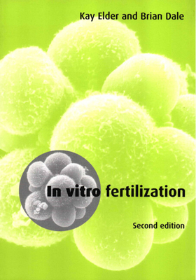 In Vitro Fertilization (Volume 0) 0521778638 Book Cover
