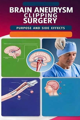 Brain Aneurysm Clipping Surgery Purpose and Sid... B0DBYTSBN8 Book Cover
