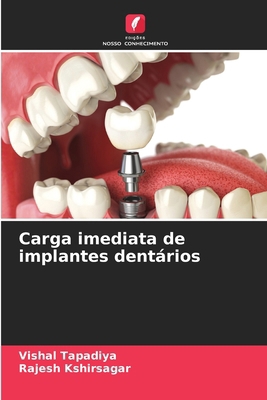 Carga imediata de implantes dentários [Portuguese] 6207660803 Book Cover