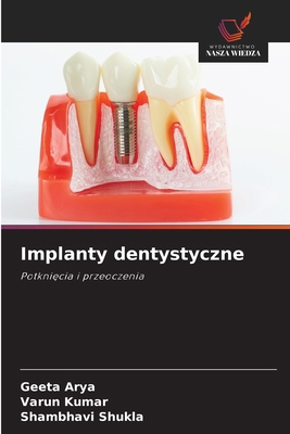 Implanty dentystyczne [Polish] 6202855487 Book Cover