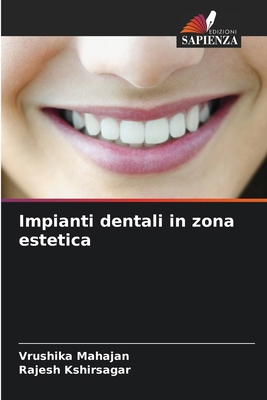 Impianti dentali in zona estetica [Italian] 620725970X Book Cover