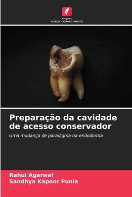 Preparação da cavidade de acesso conservador [Portuguese] 6208741319 Book Cover