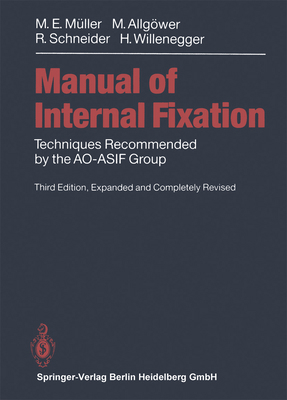 Manual of Internal Fixation: Techniques Recomme... 364208091X Book Cover