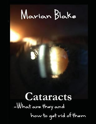 Cataracts: What are they and how to get rid of ... [Large Print] 150773879X Book Cover