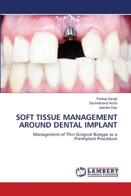 Soft Tissue Management Around Dental Implant 6208447828 Book Cover