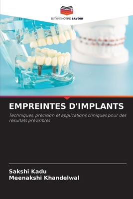 Empreintes d'Implants [French] 6209436056 Book Cover