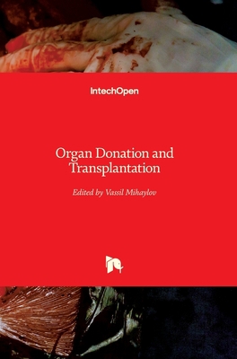 Organ Donation and Transplantation 1839625317 Book Cover