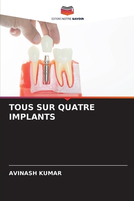 Tous Sur Quatre Implants [French] 6208300452 Book Cover