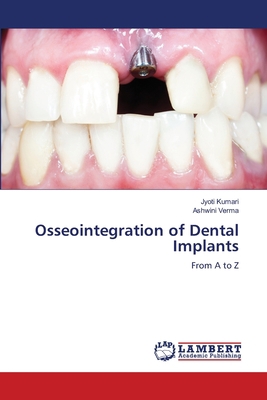 Osseointegration of Dental Implants 6205640732 Book Cover