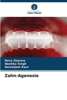 Zahn-Agenesie [German] 6207757920 Book Cover