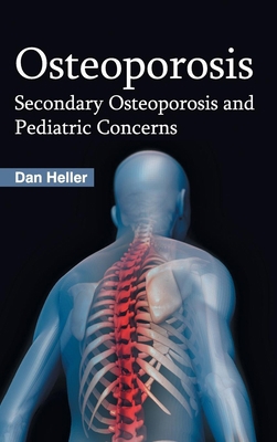 Osteoporosis: Secondary Osteoporosis and Pediat... 1632423065 Book Cover