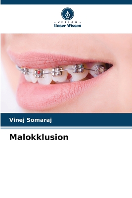 Malokklusion [German] 6205626519 Book Cover