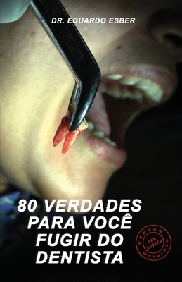 80 Verdades Para Você Fugir Do Dentista [Portuguese] B0BYBL5QX7 Book Cover