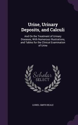 Urine, Urinary Deposits, and Calculi: And On th... 1357394683 Book Cover